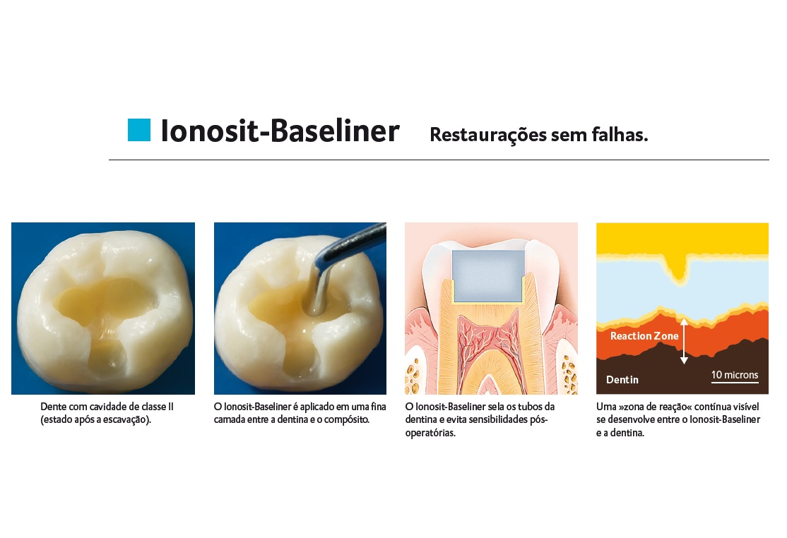 Infográfico do produto Ionômero de Vidro Ionosit Baseliner c/ 20 Unid. Infográfico do produto Ionômero de Vidro Ionosit Baseliner c/ 20 Unid.